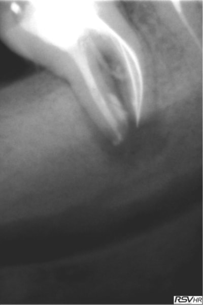 Marroux3 syospw - Eugenol