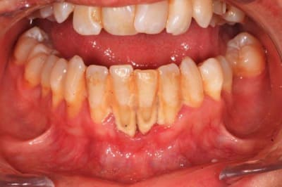 Mars2016 071 amagbl - Eugenol