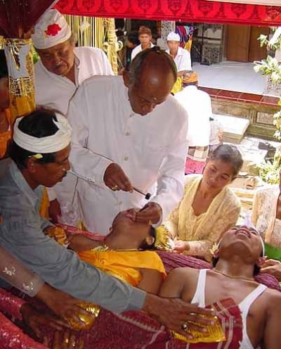 Masangih plvlov - Eugenol