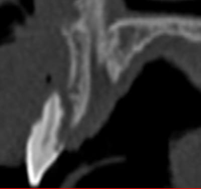 Matribon1 dfeqji - Eugenol