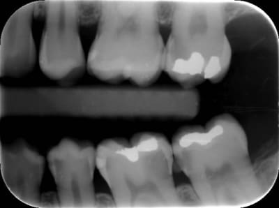 Maud tfhrhm - Eugenol