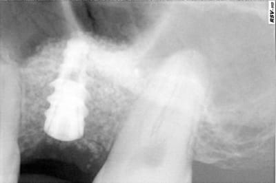 Maz qoehd4 - Eugenol