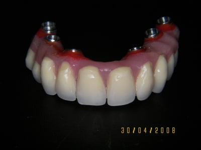 Mci app resine smiling cone mcpnmd - Eugenol