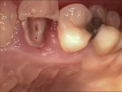 Mekb2 hzmsle - Eugenol