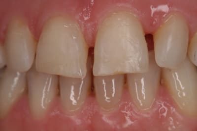 Mockup 2 pstl4m - Eugenol