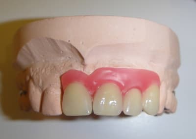 Montage 2013 4 dents x8hlbr - Eugenol