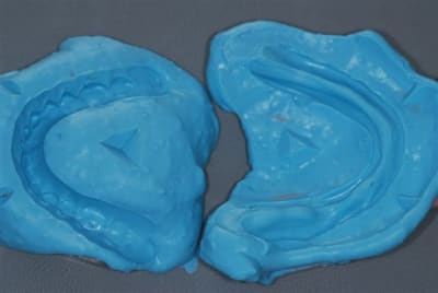 Moufle alginate thlgl0 - Eugenol