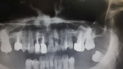Ms3gkrzyqbpq3bkaithj - Eugenol