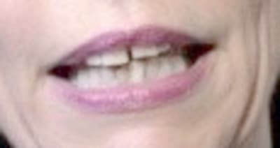 Mst iwhluq - Eugenol