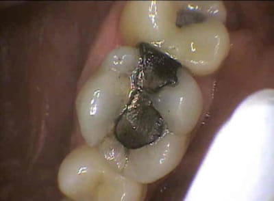 Nada yxgr60 - Eugenol