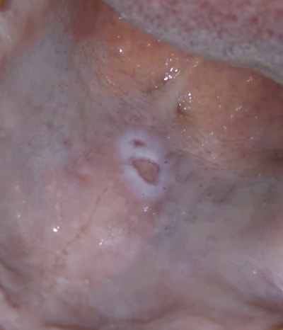 Nchpb9nci6hemjginuqr - Eugenol