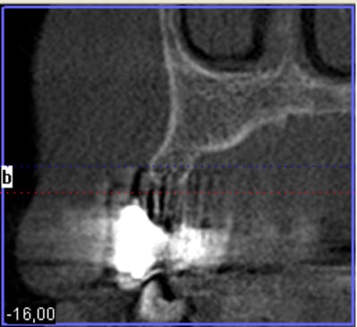 Niveau inter trai6z - Eugenol