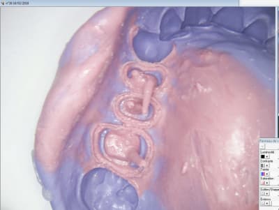 Nntlggv8ym6lokoihstn - Eugenol