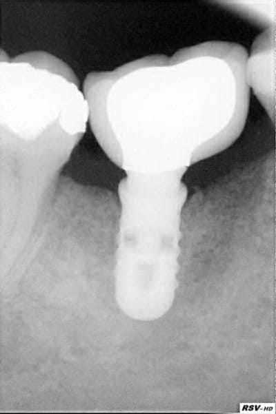 Novembre 2011 ane4ar - Eugenol