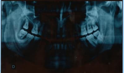 Num risation0001 vqisvv - Eugenol