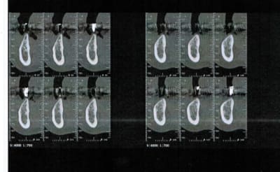Numeriser sxk2cr - Eugenol