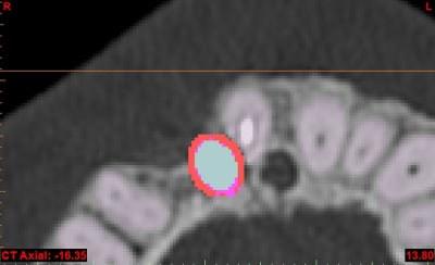 O wahiba axial xqgozf - Eugenol