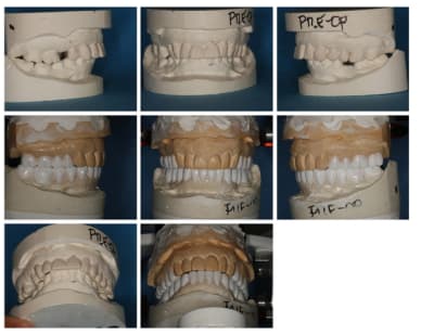 Options  2  epmjuf - Eugenol