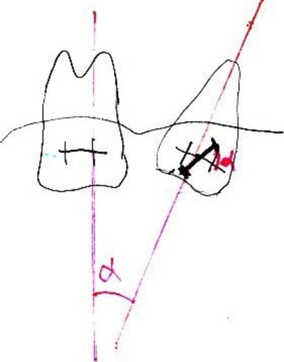 Ortho panicard peiorr - Eugenol