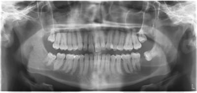 Osyrihtkx4dxhyguqcuz - Eugenol