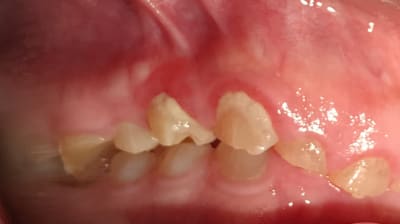 Ouyhsg5t01t9f9j55erj - Eugenol