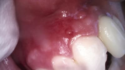 Ouyz5liwhumqppocci6q - Eugenol