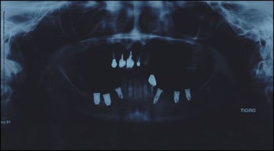 P1 bfokpq - Eugenol
