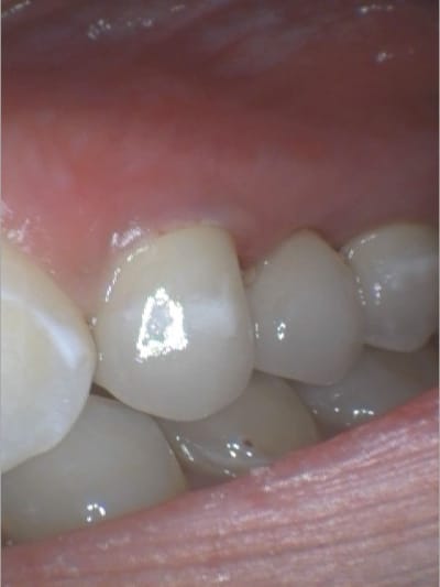P3 zay6mj - Eugenol