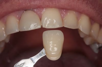 P teinte ugowf9 - Eugenol