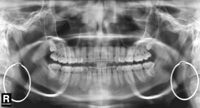 Pano lapi vi iegccw - Eugenol