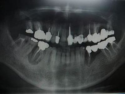 Pano0905 j8u5ih - Eugenol