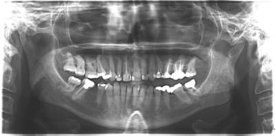 Pano1 wjqjvc - Eugenol