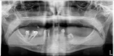 Pano cmu dv4bv4 - Eugenol