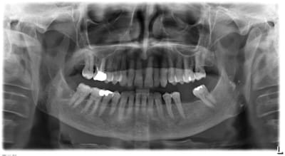 Pano  20120305 3164 zqolm7 - Eugenol