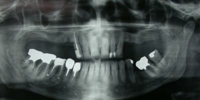 Pano aaf6px - Eugenol