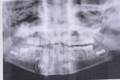 Pano i6e7uk - Eugenol