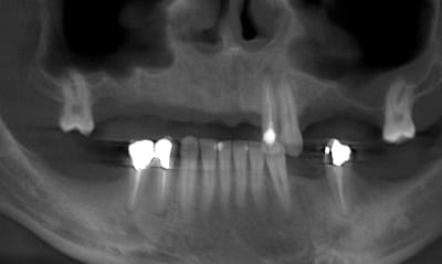 Pano initiale xhnq3l - Eugenol