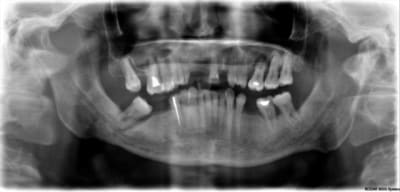 Pano q4h28x - Eugenol