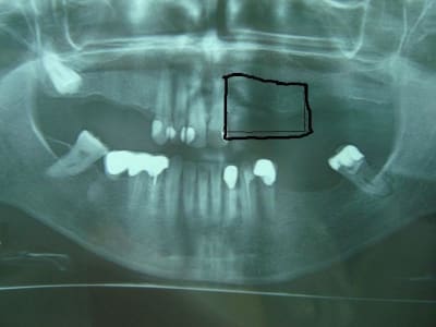 Pano s8hcv8 - Eugenol