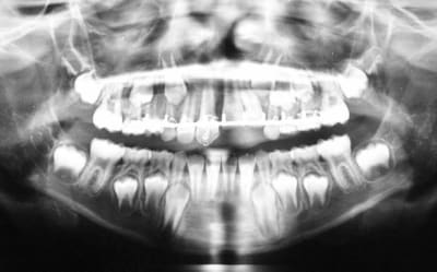 Pano s9aqgp - Eugenol