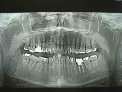 Pano tp6bh9 - Eugenol