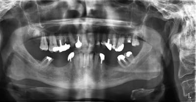 Pano uyqclc - Eugenol
