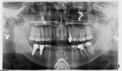 Pano wx8h5n - Eugenol