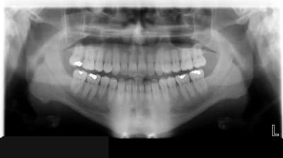 Panoramique99 leh9i3 - Eugenol
