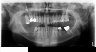 Panoramique y5f5w4 - Eugenol