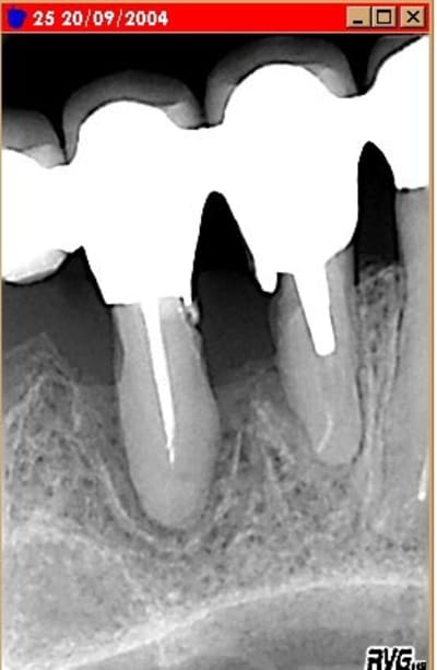 Paro bridge2 zzpkly - Eugenol