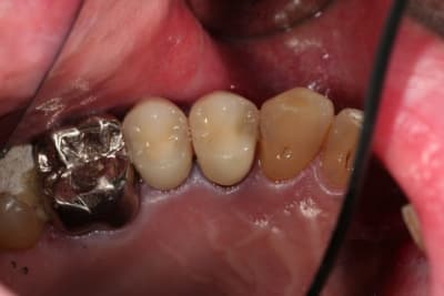 Paro 1 zjbjk6 - Eugenol