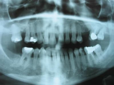 Paro pano umgfdg - Eugenol