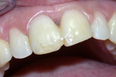 Pas0 romstn - Eugenol