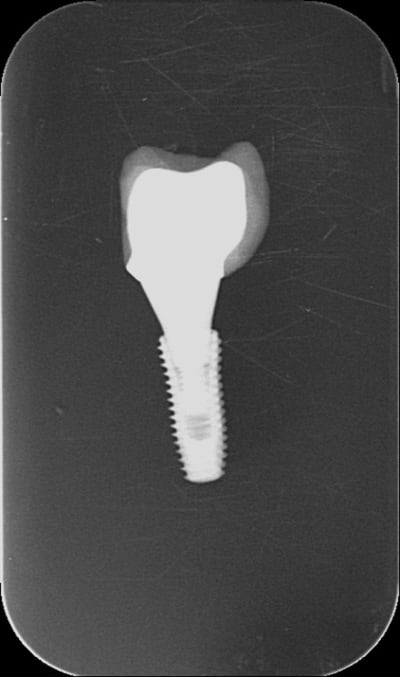 Pasbon hhzjzg - Eugenol